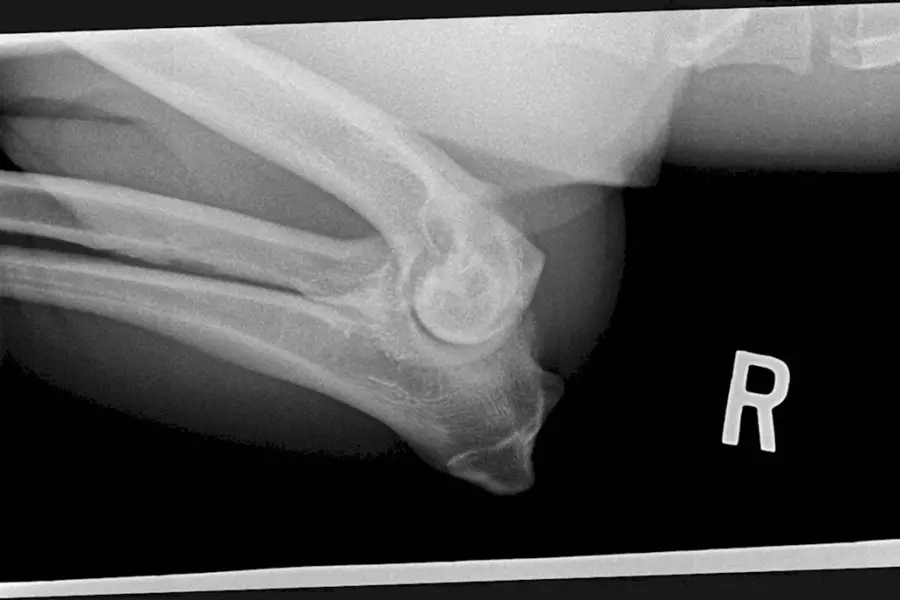 Локтевой сустав собаки рентген норма